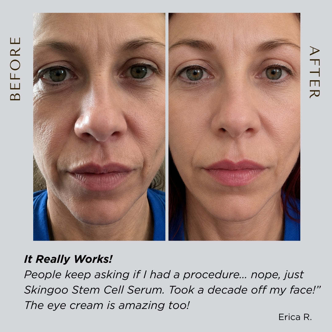 Triple Power Stem Cell Eye Cream + Vitamin C – Skingoo®
