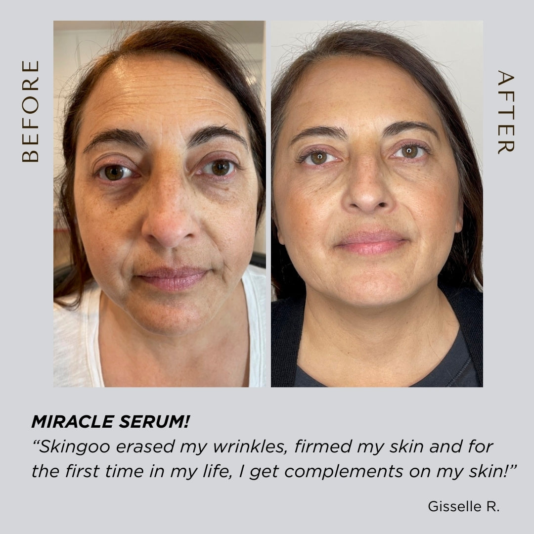 Stem Cell Serum Three-Pack – Skingoo