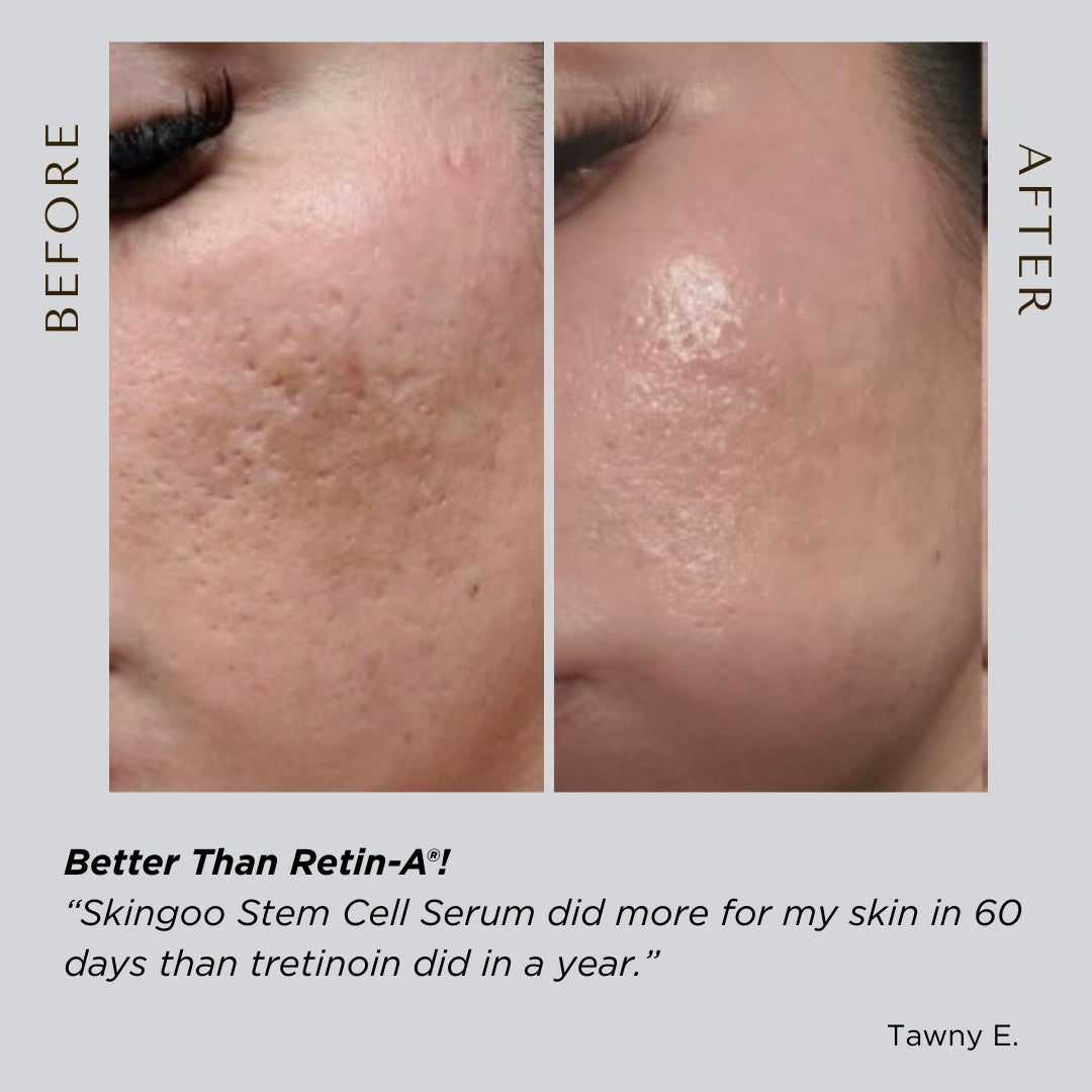 Stem Cell Serum with Vitamin C + B3 – Skingoo